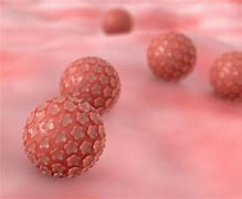 Image result for Human Papillomavirus Infection