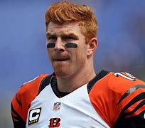 Image result for Andy Dalton Head