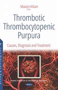 Image result for Thrombocytic Thrombotic Purpura
