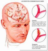 Image result for acatal�vtico