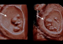 Image result for 9 Week Old Chest