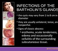 Image result for Anogenital Infection