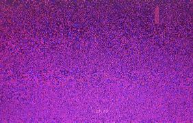 Image result for TV Static No Signal GIF