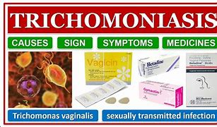 Image result for Vaginali Trichomonas Infection