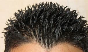 Image result for 1 Cm Hair