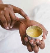 Image result for Topical Medication