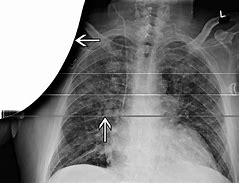 Image result for radiographic