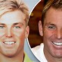 Image result for Shane Warne Early Years