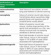 Image result for Anencephaly vs Microcephaly