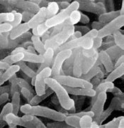 Image result for corynebacterium_diphteriae