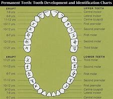 Image result for SRP Teeth