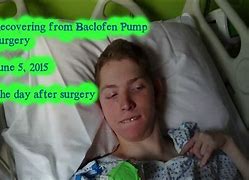 Image result for Recover Patient