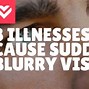 Image result for Central Blurry Vision