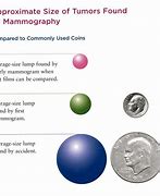 Image result for How Big Is a 10Mm Tumor