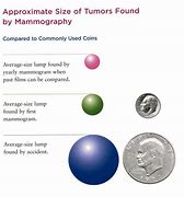 Image result for How Big Is a 12 Cm Tumor