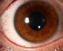 Image result for Soft Contact Lens