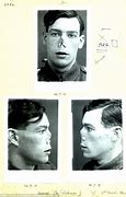 Image result for WWI Injuries