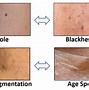 Image result for Face Skin Conditions