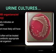 Image result for Type of Urine Culture