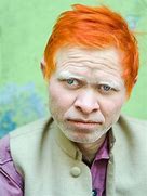 Image result for Albino Indian