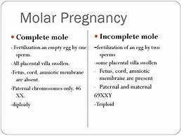 Image result for Treatment of Molar Pregnancy
