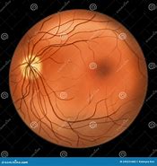 Image result for Normal Eye Retina