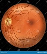 Image result for Normal Eye Retina