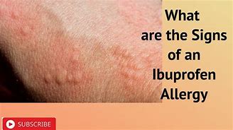 Image result for Ibuprofen Allergic Reaction