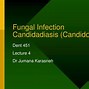 Image result for Pseudomembranous Candidiasis