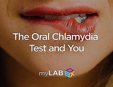 Image result for Chlamydia in the Mouth
