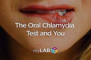 Image result for Chlamydia On Tongue