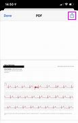 Image result for ECG On Apple Watch 6