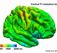 Image result for Pea Brain MRI