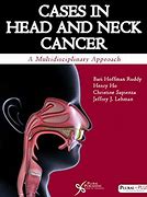 Image result for Head and Neck Cancer Case Sheet