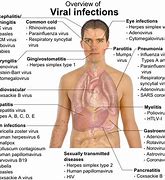 Image result for Systemic Viral Infection