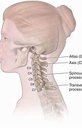 Image result for C5 C6 Cervical Spine Anatomy Diagram