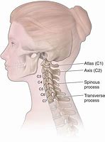 Image result for C4 Spine