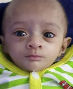 Image result for Smallest Baby Born