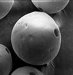 Image result for Electron Microscopy Picture of the Mpox