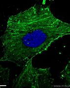 Image result for actin�metrp