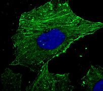 Image result for actin�mstro
