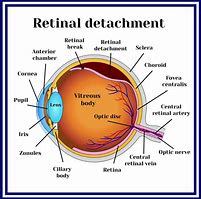 Image result for Eye Retina Image