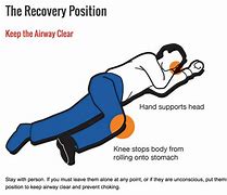 Image result for Side Lying Recovery Position
