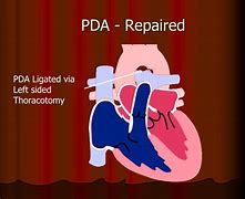 Image result for PDA Medical