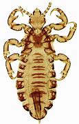 Image result for Pediculus