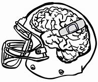 Image result for Football Player Concussion