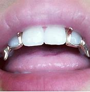 Image result for Sharp Teeth Caps