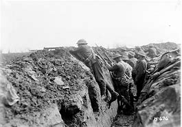 Image result for Front Line Trenches WW1