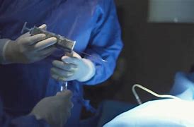Image result for What Is a Percutaneous Drain