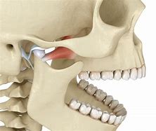 Image result for TMJ Jaw Pexel